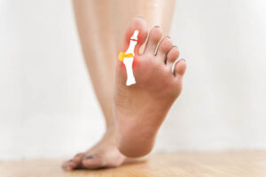 l’oignon de pied